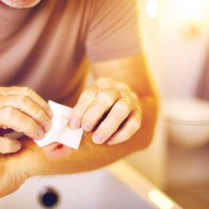 Morsure: le geste clé pour prévenir l'infection